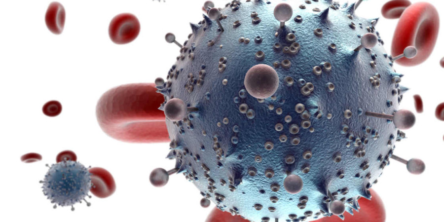 Un Britannique pourrait être le premier malade guéri du VIH après un traitement « pointu »