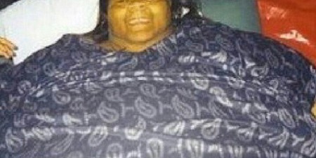 Insolite : La plus grosse femme du monde a perdu la moitié de son poids