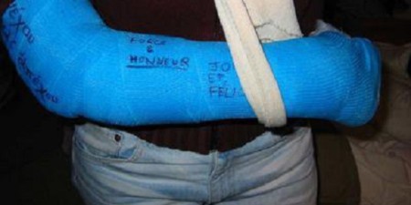 Warkhokh (Linguère): Leur cambriolage échoue, les malfrats bastonnent et fracturent le bras du responsable de cet échec