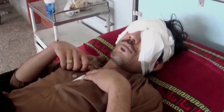 Désaccord familial : sa famille lui crève les yeux parce qu’il voulait  épouser sa petite-amie