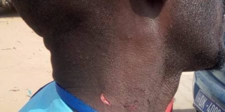 Violenté par un garde rapproché de Macky Sall : Le frère de DJ Boub’s Pape Doudou Diallo menace de porter plainte