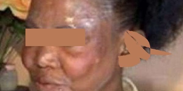 Lutte contre la dépigmentation Artificielle :Qui pour être Kagamé ? Par le Pr Fatimata Ly