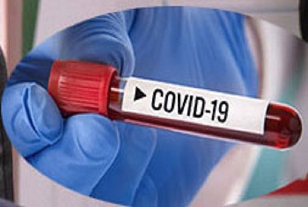 Lutte contre le coronavirus : Vers la production de tests rapides de diagnostic à Dakar