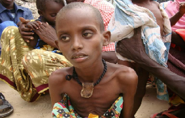 Nouveau rapport des Nations Unies :  122 millions de personnes supplémentaires sont touchées par la faim depuis 2019, en raison de crises multiples.