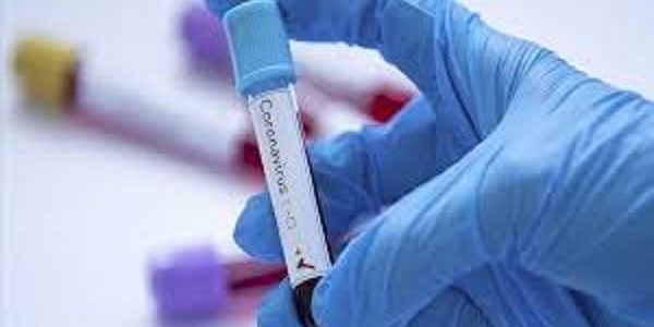 Quand les épidémies ouvrent la porte aux régimes totalitaires ! Par Adama Aly Pam