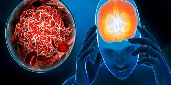 Quand l’émotion emporte le cœur : réfléchir, prévenir, se souvenir🧠  Dr Oumou cardiologue