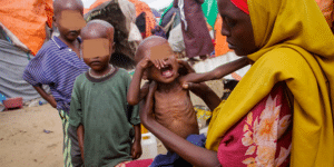 Faim et malnutrition en Somalie : 5,4 millions de personnes menacées, l’ONU redoute l’impact des inondations annoncées