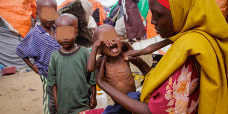 Faim et malnutrition en Somalie : 5,4 millions de personnes menacées, l’ONU redoute l’impact des inondations annoncées