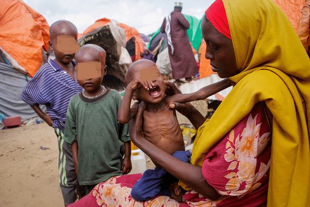 Faim et malnutrition en Somalie : 5,4 millions de personnes menacées, l’ONU redoute l’impact des inondations annoncées